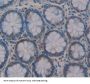 IL17F Antibody