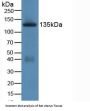Jagged 1 Protein (JAG1) Antibody
