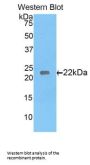Laminin Gamma 1 (LAMC1) Antibody