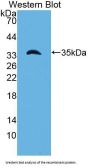 Laminin Gamma 1 (LAMC1) Antibody