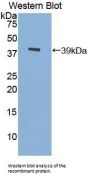Metallothionein 3 (MT3) Antibody