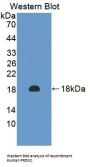 Peroxiredoxin 2 (PRDX2) Antibody