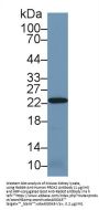 Peroxiredoxin 2 (PRDX2) Antibody