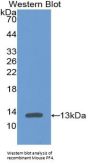 Platelet Factor 4 (PF4) Antibody