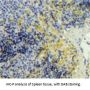 Platelet Factor 4 (PF4) Antibody