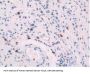 Platelet Factor 4 (PF4) Antibody