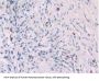 Platelet Factor 4 (PF4) Antibody