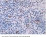 Platelet Factor 4 (PF4) Antibody