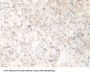 Pyridoxal Kinase (PDXK) Antibody