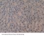 Topoisomerase II (TOP2) Antibody