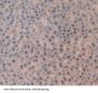 Topoisomerase II (TOP2) Antibody