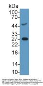 C Reactive Protein (CRP) Antibody