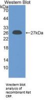 C Reactive Protein (CRP) Antibody