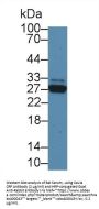 C Reactive Protein Antibody
