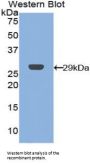 C Reactive Protein Antibody