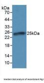 C Reactive Protein (CRP) Antibody