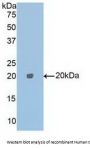 Carboxypeptidase E (CPE) Antibody
