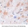 Carboxypeptidase E (CPE) Antibody