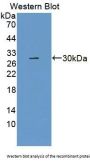 Docking Protein 3 (DOK3) Antibody
