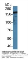 Integrin alpha M Antibody