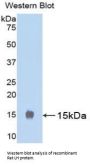 Luteinizing Hormone (LH) Antibody