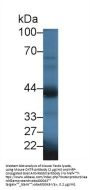 Oxytocin Receptor (OXTR) Antibody