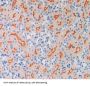 Oxytocin Receptor (OXTR) Antibody