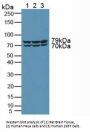 Serine/Threonine-Protein Kinase D2 (PRKD2) Antibody