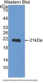 Thyroid Peroxidase Antibody