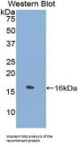 Tryptase Delta 1 (TPSd1) Antibody