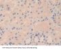 Tryptase Delta 1 (TPSd1) Antibody