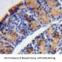 Tryptase Delta 1 (TPSd1) Antibody