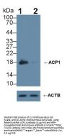 Acid Phosphatase 1 (ACP1) Antibody