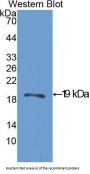 Acid Phosphatase 1 (ACP1) Antibody