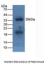 Apolipoprotein A5 (APOA5) Antibody