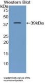Apolipoprotein C-I (APOC1) Antibody