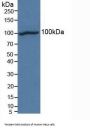 Cadherin, Neuronal (CDH2) Antibody