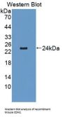 Cadherin, Neuronal (CDH2) Antibody