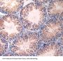 Cadherin, Neuronal (CDH2) Antibody
