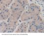 Coagulation Factor V Antibody