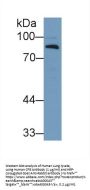 Complement Factor B (CFB) Antibody