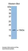 Complement Factor B (CFB) Antibody