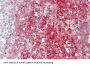 Complement Factor B (CFB) Antibody