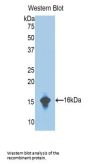Complement Factor B (CFB) Antibody