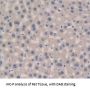Complement Factor B (CFB) Antibody