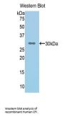 Complement Factor I Antibody