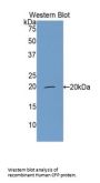 Complement Factor P (CFP) Antibody