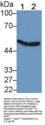 Complement Factor P (CFP) Antibody