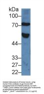 Frizzled Homolog 1 (FZD1) Antibody