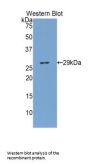 Glucuronidase Beta (GUSb) Antibody